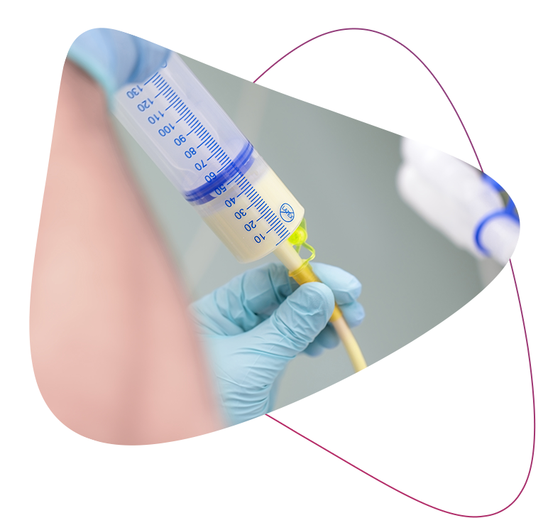 Enteral Feeding